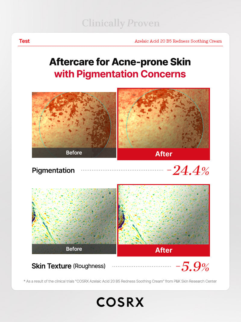 COSRX Azelaic Acid 20 B5 Redness Soothing Cream - Image 10